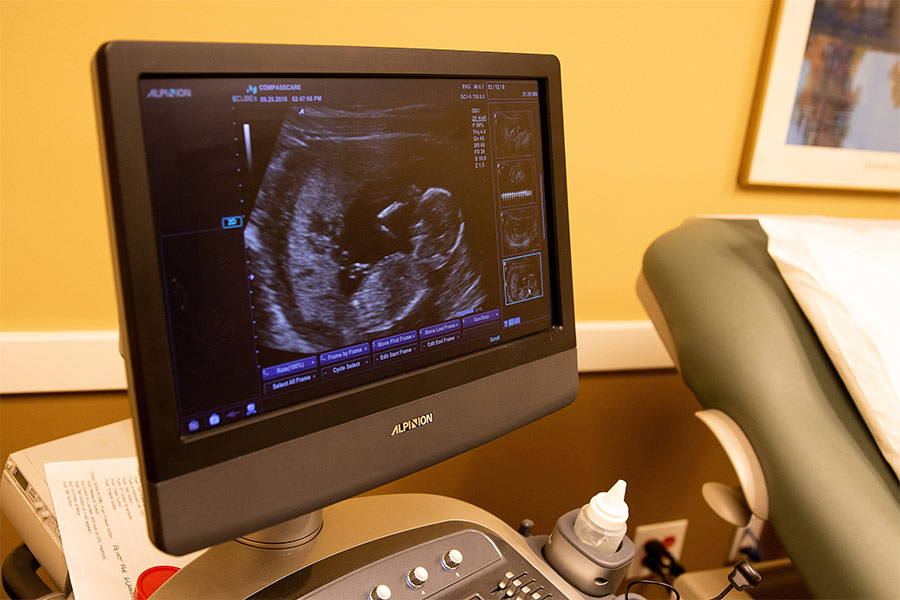 An ultrasound is seen at a pregnancy center